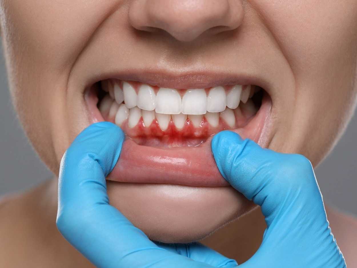 Dentist discussing oral health with a patient
