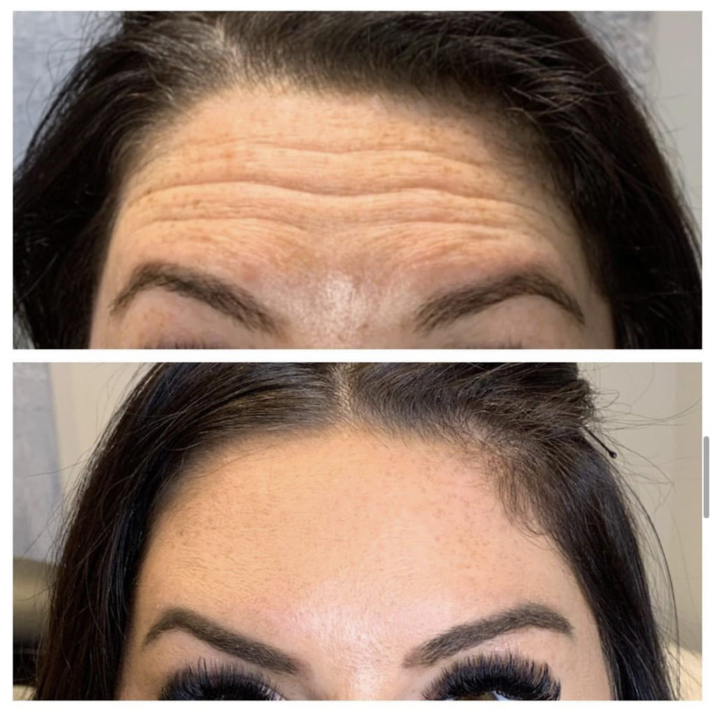 Facial aesthetic consultation