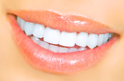 Natural-looking smile