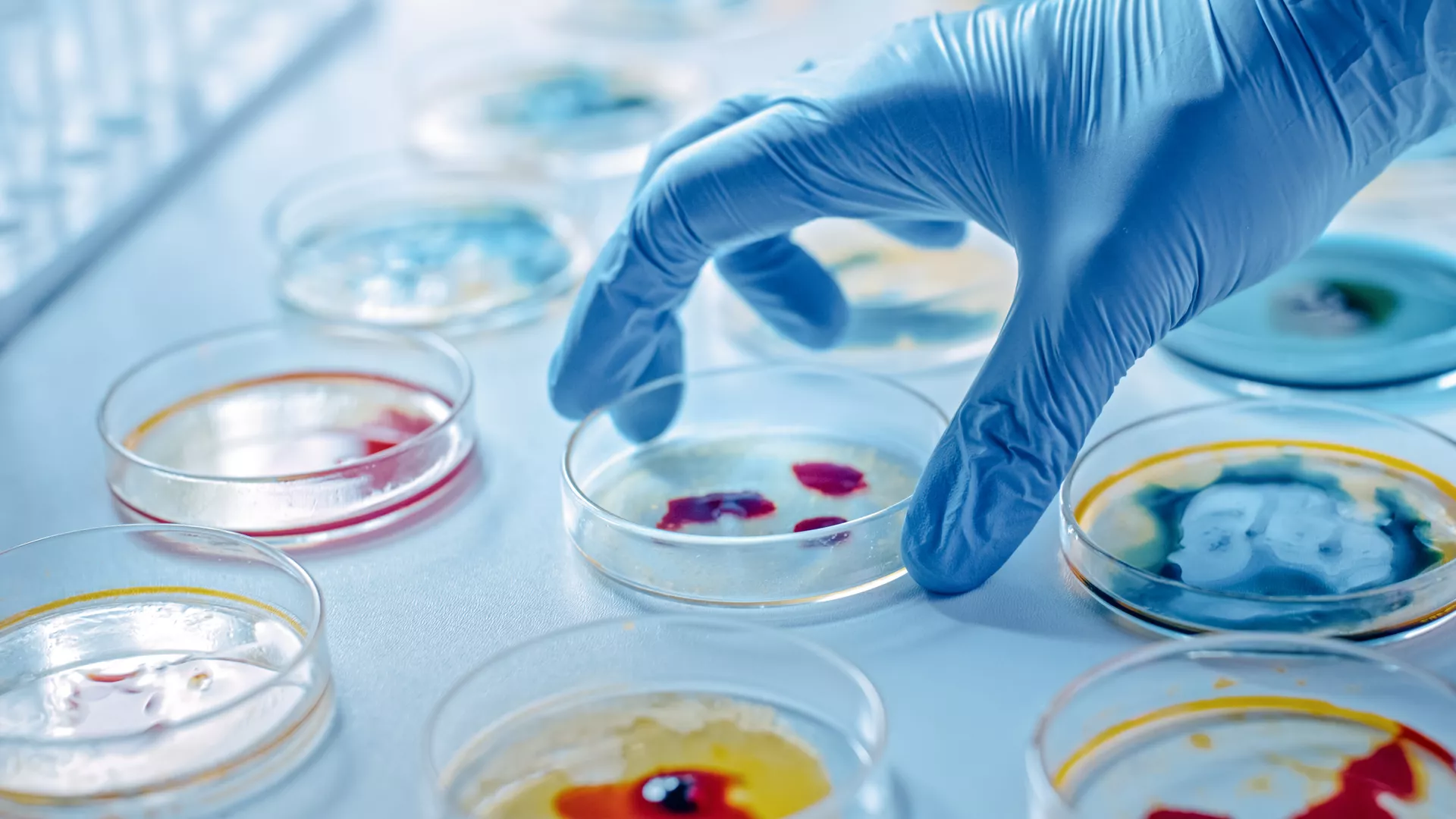 Microbiology laboratory testing
