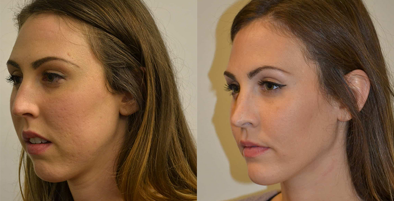 Facial aesthetic assessment