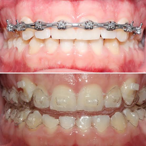Patient receiving dental care