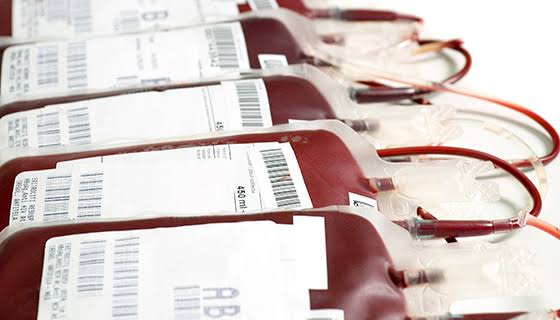 Blood specimen preparation in a laboratory