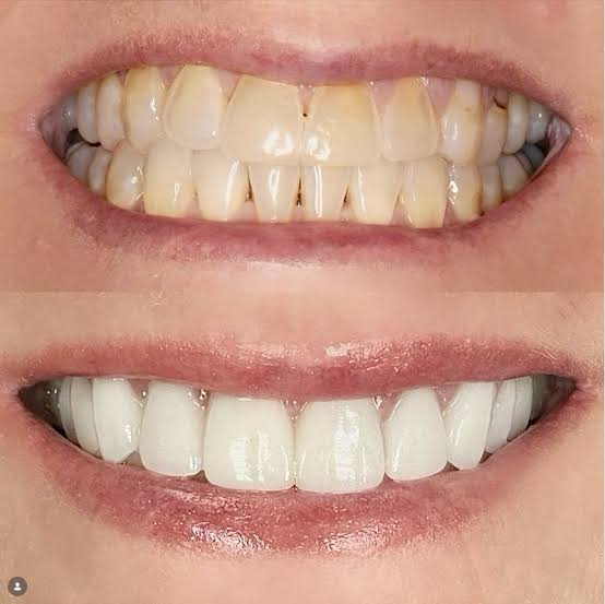 Dental care and smile assessment