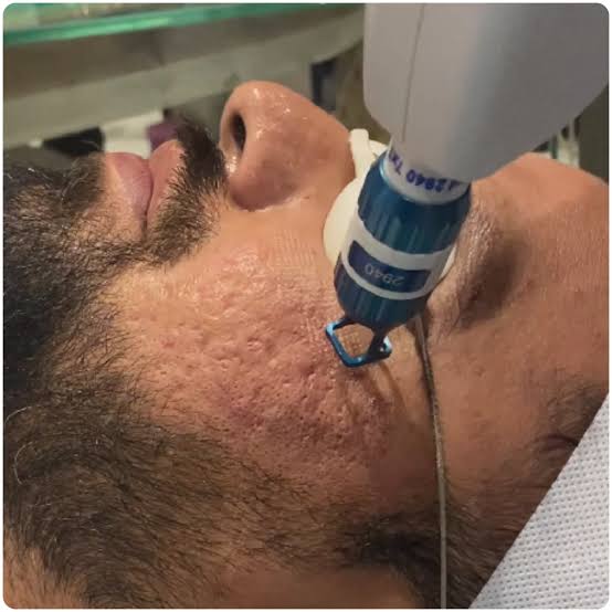 Professional skincare treatment
