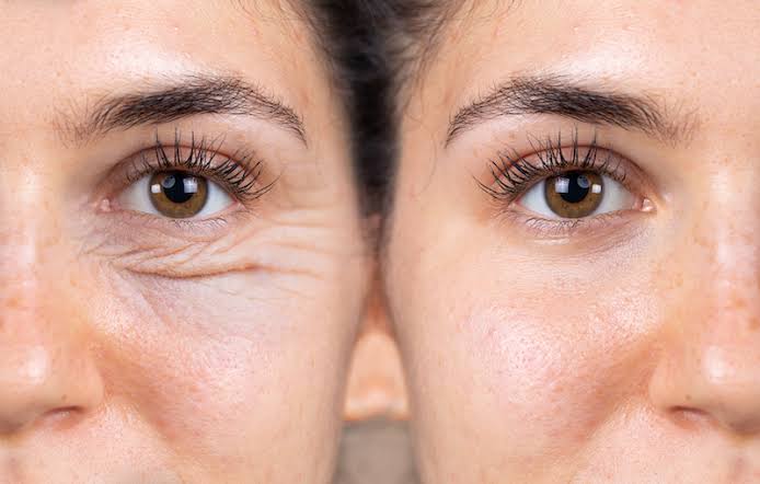 Aesthetic skin treatment