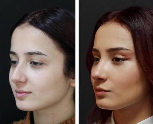 Facial profile for aesthetic consultation
