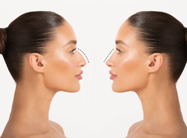 Facial features and profile