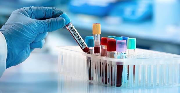 Laboratory blood sample analysis