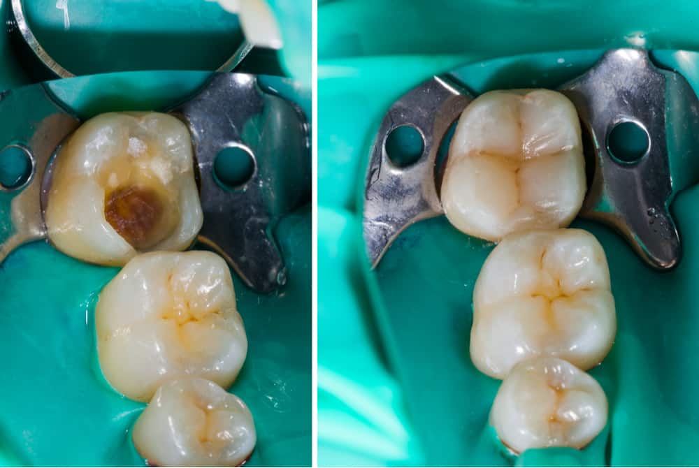 Dental examination and oral care